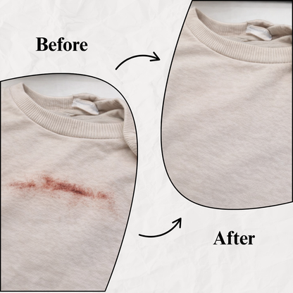 Instant Blood Stain Remover for Clothes (8.79oz)